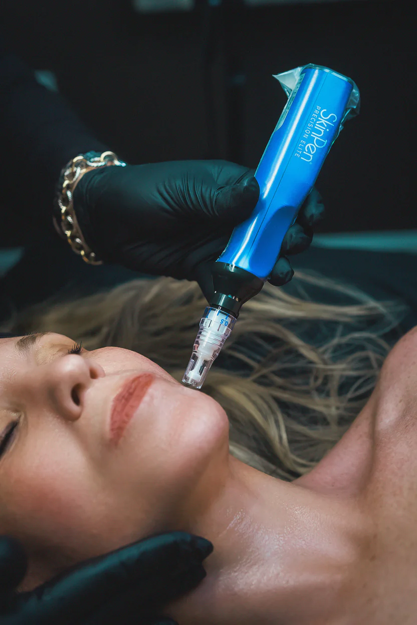 SkinPen Microneedling Special