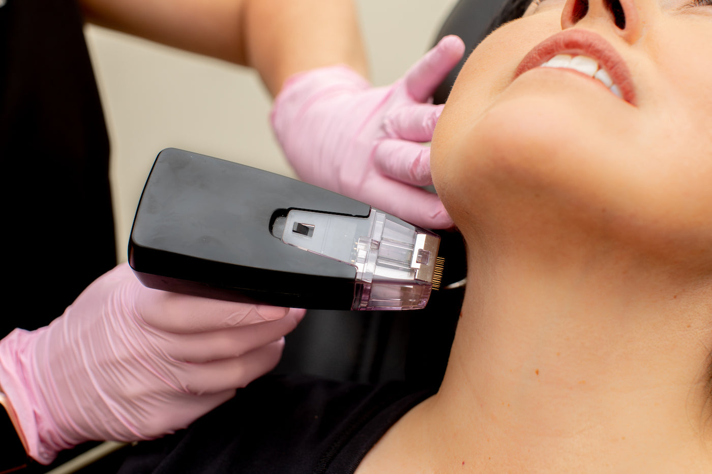 Morpheus8 RF Microneedling Spring Hill | Divinity MedSpa