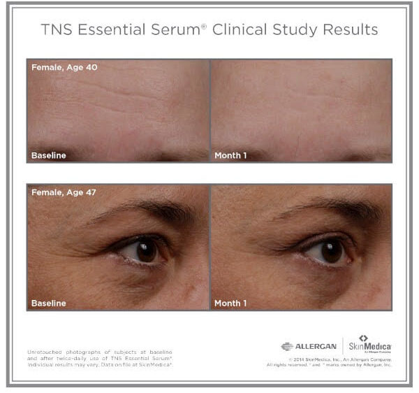 tns-essential-serum-results